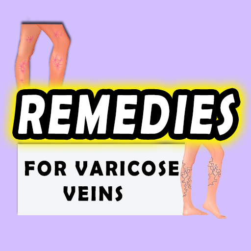 Remedies for Varicose Veins