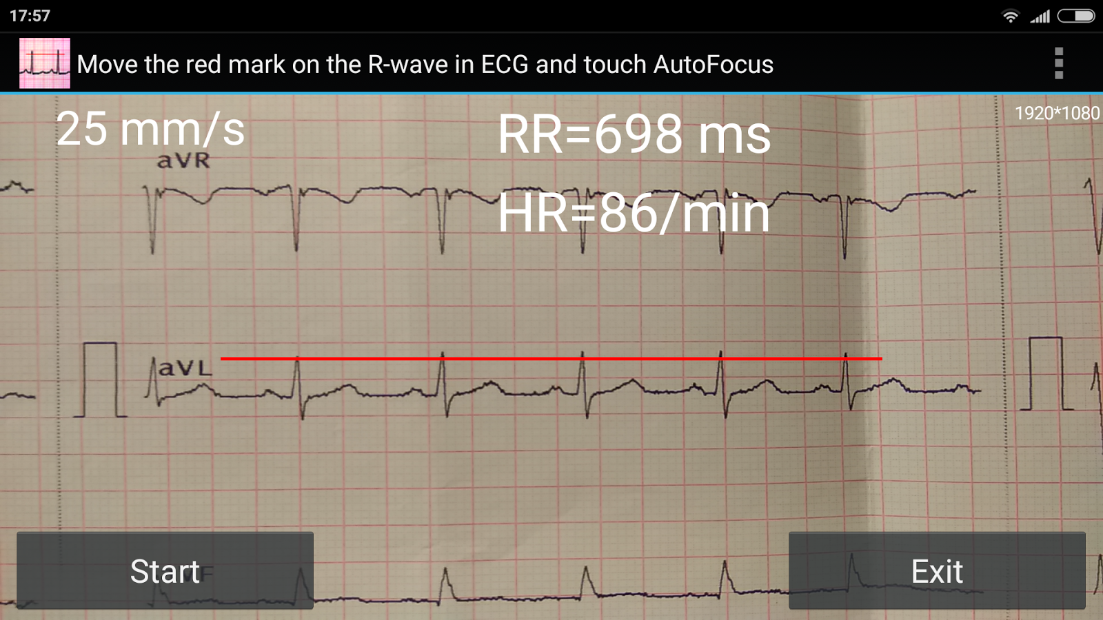 ECG RR Reader (b) Screen 3