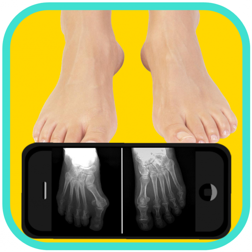 Prank X-Ray Foot Skeleton