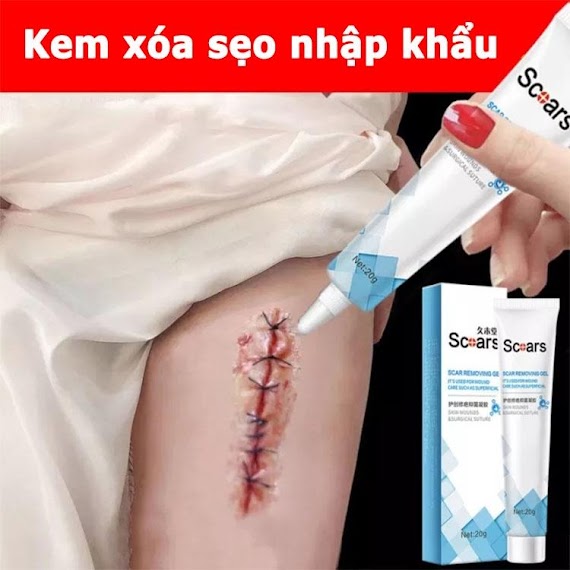 Kem Xóa Sẹo, Loại Bỏ Hiệu Quả Các Vết Sẹo Lâu Năm, Sẹo Phẫu Thuật, Phục Hồi Và Làm Sáng Các Vết Rạn Da Khi Mang Thai, Xó