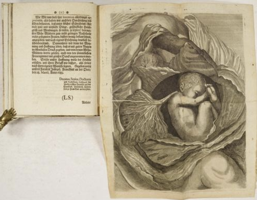 Medical textbook with text on the left page and a baby in utero on the right side