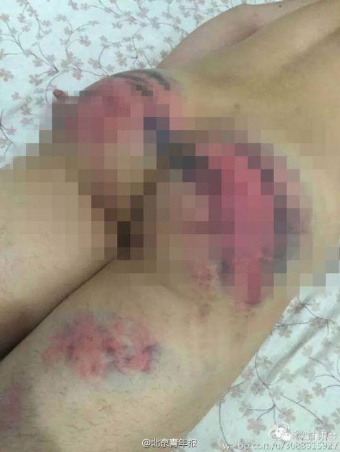 警方回应大学生屁股被警察打开花