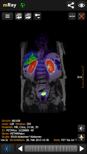 mRay - DICOM Viewer