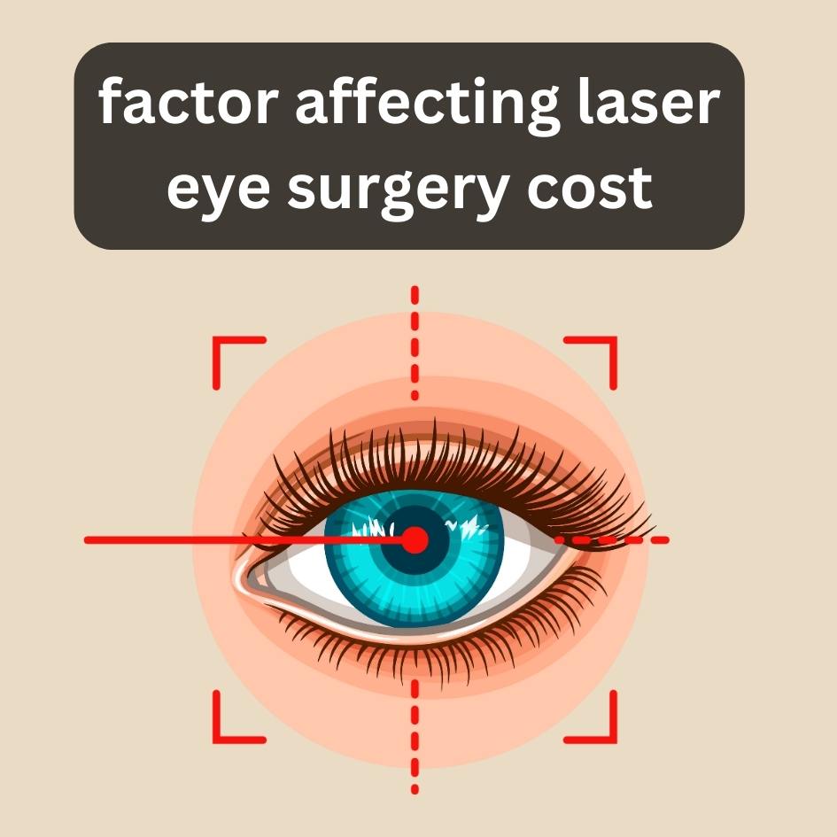 factors affecting laser eye surgery cost