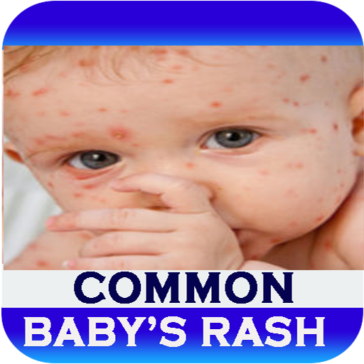 Baby's Rash Guide