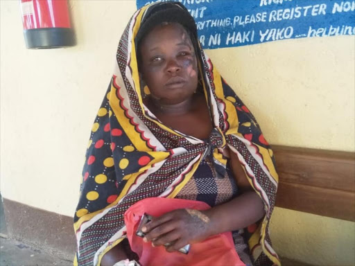 Hannah Muthoni at J.M.Memorial hospital on Wednesday, February 13, 2019.