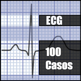 ECG 100 casos prácticos