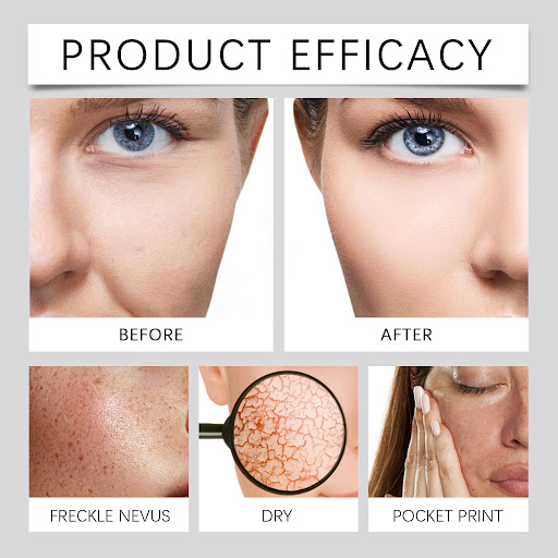 Title 10, Snail Moisturizing Facial Cream Nourishing And ...