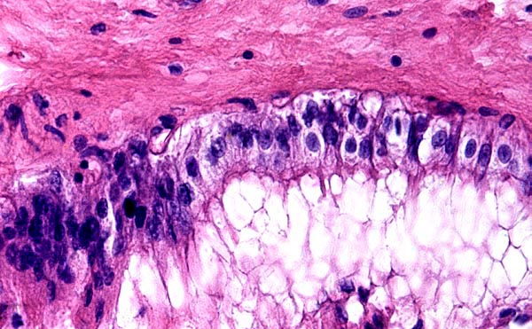 Chorionic surface