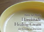 Neem Cream for Eczema and Psoriasis was pinched from <a href="http://www.lovelygreens.com/2012/05/handmade-healing-cream-for-eczema-and.html" target="_blank">www.lovelygreens.com.</a>