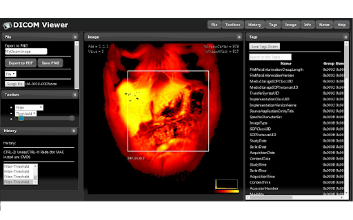 Dicom Image Viewer