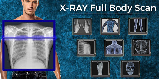 XRay Body Scanner Prank