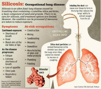 health-silicosis_graphic-bimari