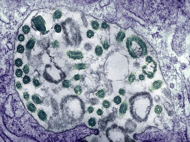 The Marburg virus was first detected in the city of Marburg in Germany in 1967