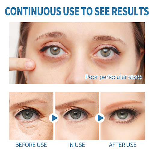 Title 4, Elastic moisturizing eye gel patches for refres...