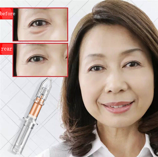 Title 2, Eye cream that lightens fine lines, dark circle...