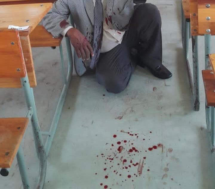 Education official Shakeel Isseri was attacked by a group of men armed with pangas and a gun at a school in Umlazi, outside Durban in KwaZulu-Natal on Tuesday.