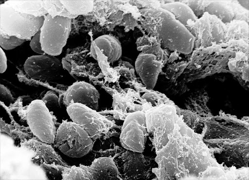 Scanning electron micrograph depicting a mass of Yersinia pestis bacteria. Pneumonic plague is both a rarer and more virulent form of the bubonic plague, which is caused by that bacteria.