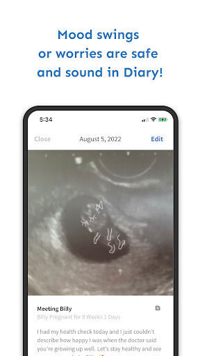 Screenshot Baby Billy - Pregnancy & Baby