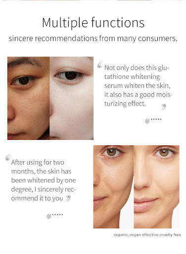 Title 6, Discoloration improvement, brightening, and whi...