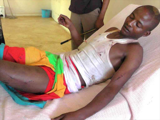 Joseph Loldapash, a victim of police brutality receiving treatment at kimanjo sub-county hospital. He allegedly received a thorough beating from a police officer after a misunderstanding with the latter's woman friend.