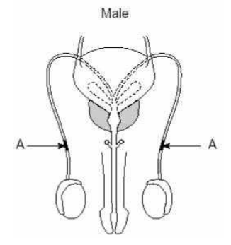 Surgical Methods