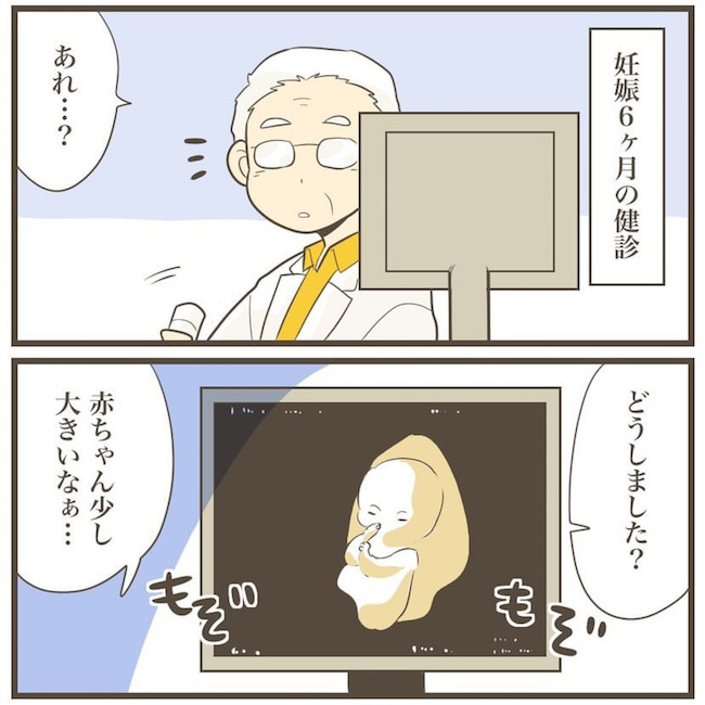 体重管理が悪かった 巨大児の兆候に対する医師の意外な説明とは 2人目は巨大児9 Trill トリル
