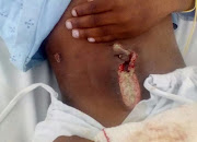 The 8-year-old boy was discharged from Madadeni hospital in Newcastle on Monday with an open wound‚ following an appendix operation.