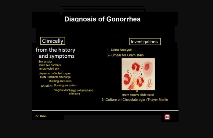 How to diagnose Gonorrhea infection