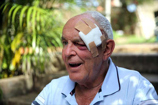 73 year old Bonza Bay resident Terry Rurter speaks to the media about his near fatal assault after being mugged while running on Bonza Bay beach last week. PICTURE ALAN EASON