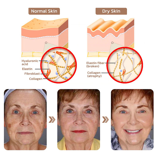 Title 4, Fading Wrinkle Firming Skin Care Solution. Redu...