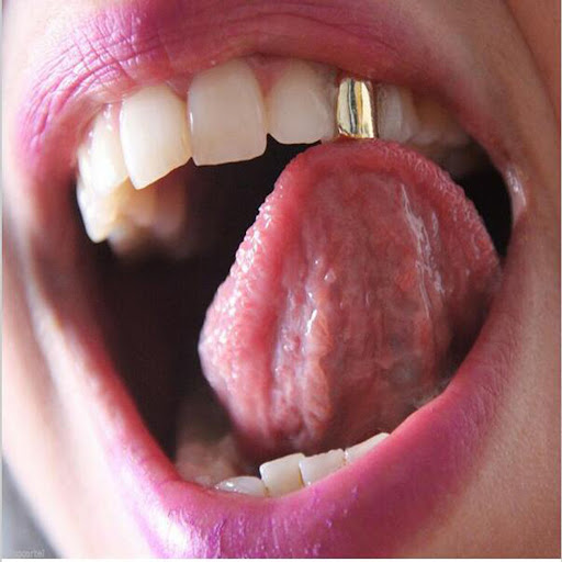 Title 1, HIPHOP Gold-plated Single Tooth Socket