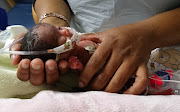 Micro-premature baby Jazeel Hlope. Image: NETCARE
