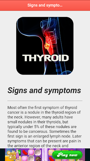 Thyroid Cancer