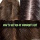 Download Get Rid Of Dandruff For PC Windows and Mac 1.0