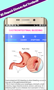 All stomach diseases and treatment(圖1)-速報App