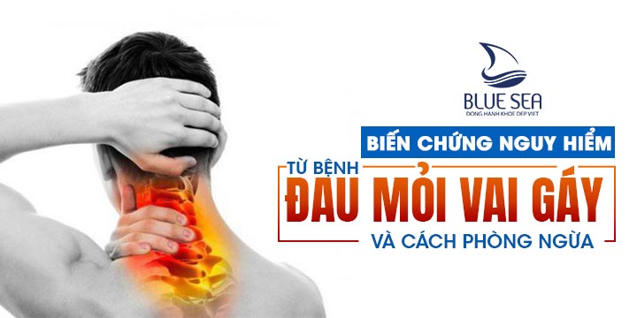 Đau mỏi vai gáy gây ra những biến chứng nguy hiểm.