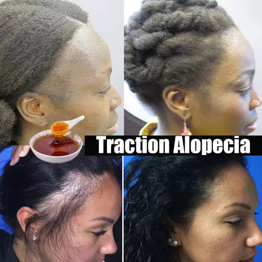Title 4, Africa Naturl Herbal Shampoo Crazy Hair Growth ...
