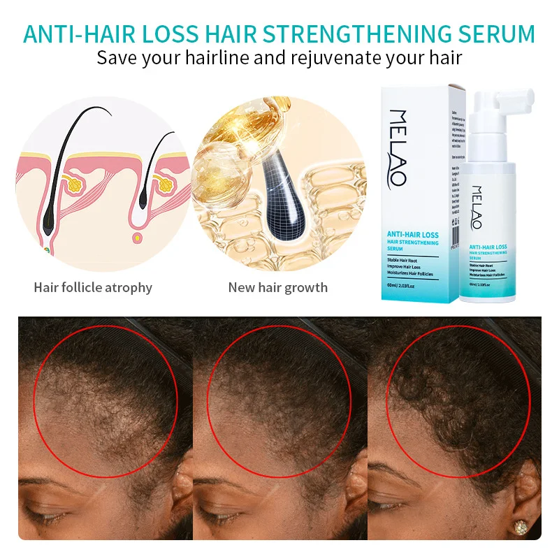 Growing Hair Growth Liquid Scalp Care Tough Strengthens Hair, Reduces Hair Fall, Stimulates Natural Growth, and Promotes