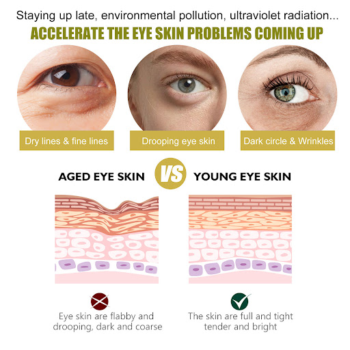 Title 6, Fading Wrinkle Dark Circles Eye Mask hydrates, ...