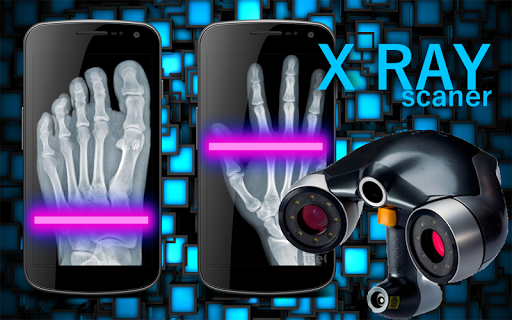 Xray Photography Scan Prank