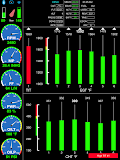 BlueMAX Engine Monitoring