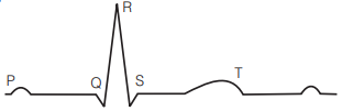 Cardiac Cycle