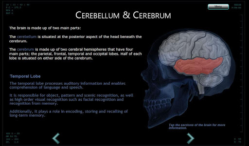 Interactive Brain Anatomy -MRI