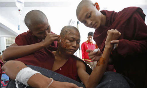 A monk receives treatment after police fired water cannon and teargas during a crackdown on protests against the copper mine in Monywa, Burma.