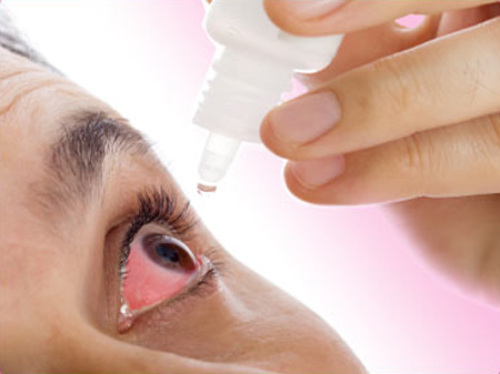 Điều trị viêm giác mạc do virus