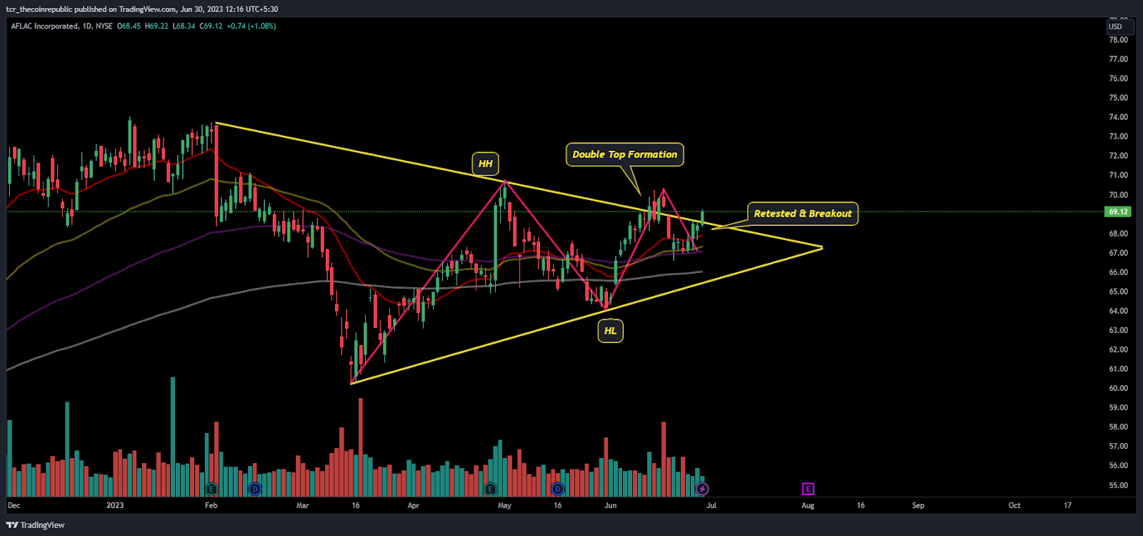 Aflac Inc. (NYSE: AFL) Forming a Double-top Pattern; What Next?