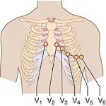 Cover Image of Download Clinical ECG Guide. 2.3.4.5.7 APK