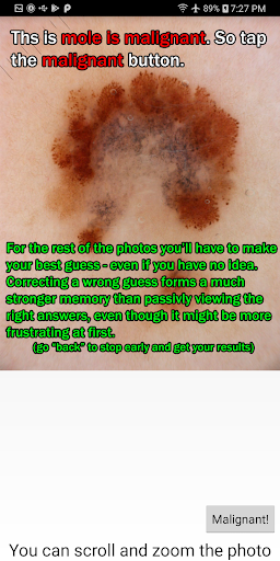 Screenshot Skin Cancer Flashcard "game"