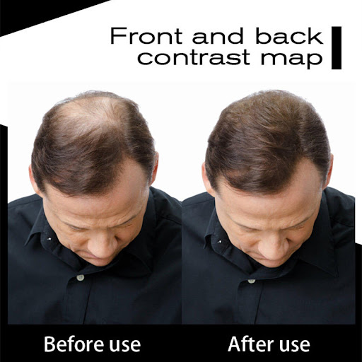 Title 6, Sevich 50g Hair Fibers for an Instantly Thicker...